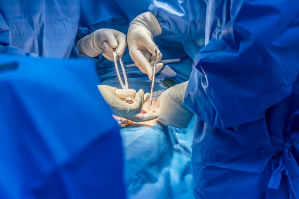 Hernia operation theatre