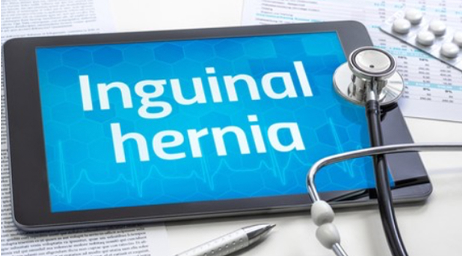 INGUINAL HERNIA AN OVERVIEW